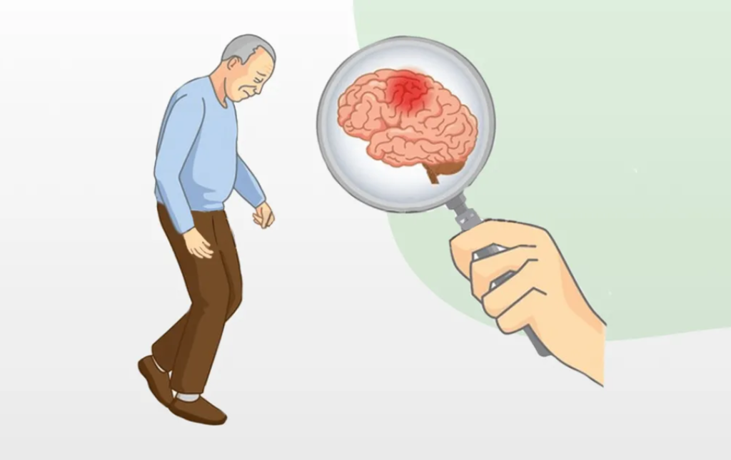 parkinson treatment in india