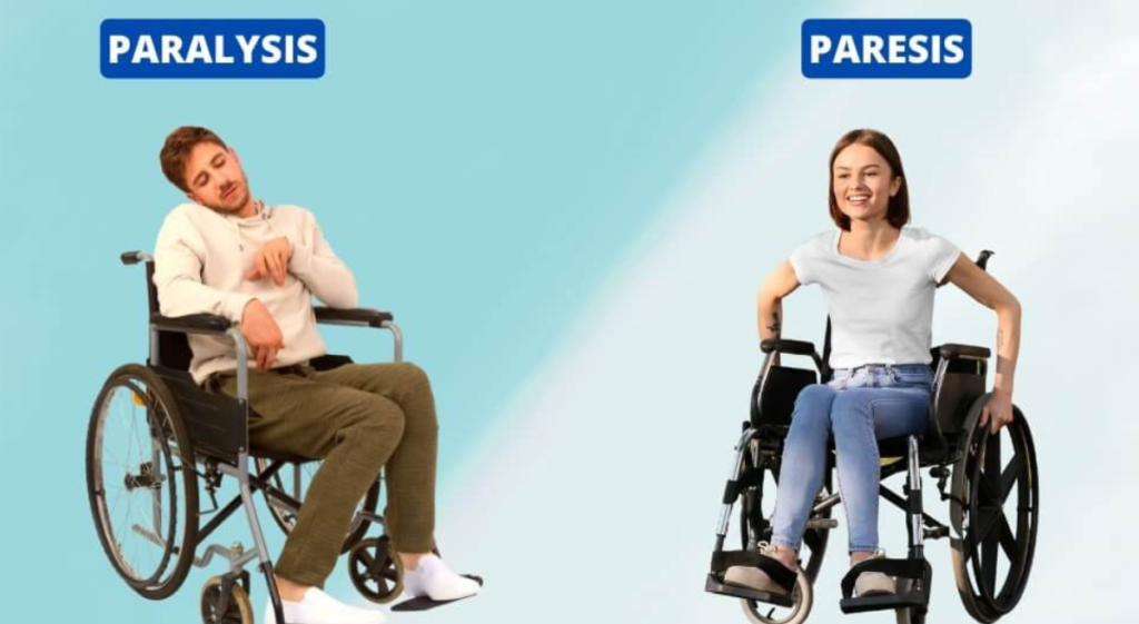 Differences Between Paresis and Paralysis