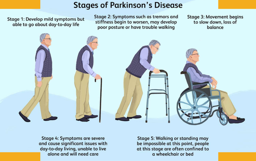 Exploring the 5 Stages of Parkinson's Disease