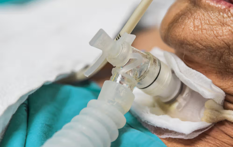 Understanding the Basics of Tracheostomy Care: What You Need to Know