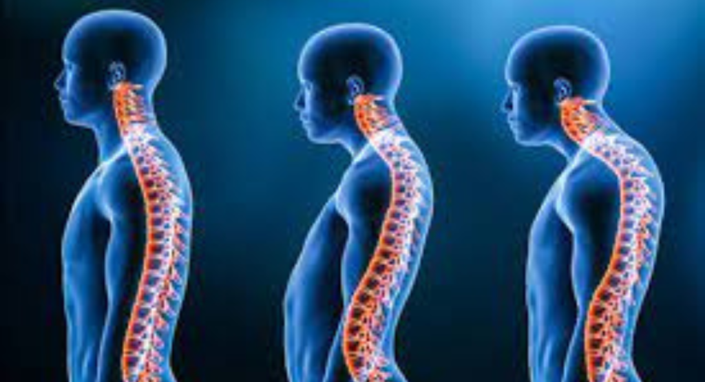 Spinal Deformities Causes Symptoms And Treatment Options In India